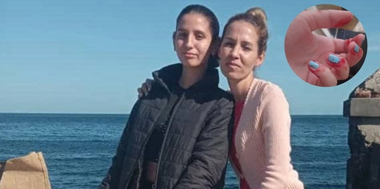 Adolescente en Mayabeque sufre hematidrosis y enfrenta el abandono del colapsado sistema sanitario cubano