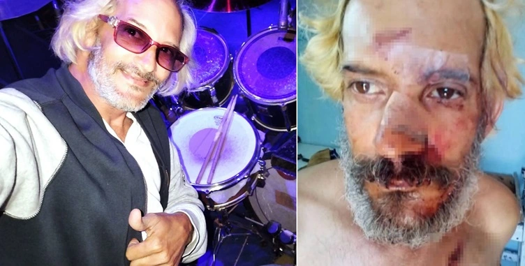 Baterista Eduardo Longa sufre violento asalto en La Habana ante el avance de la inseguridad ciudadana